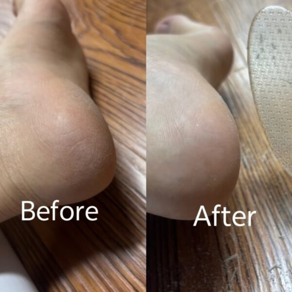 Lrris Glass Foot File