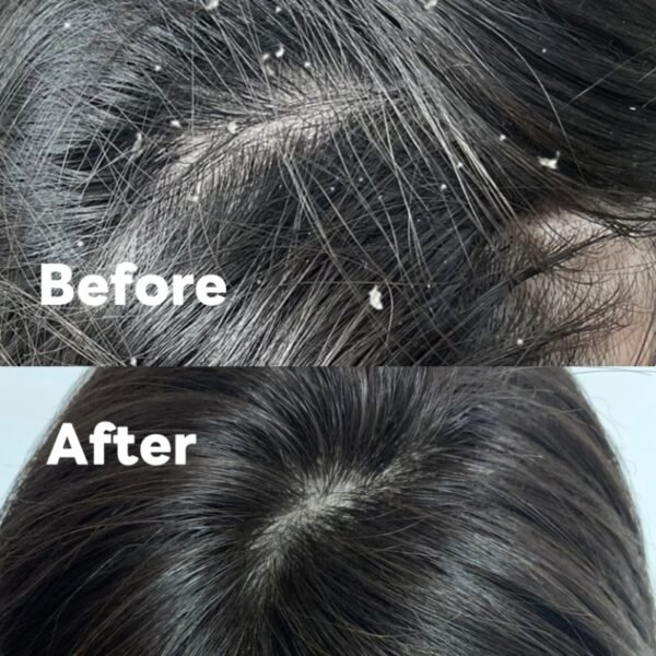 Everyday Essentials Set